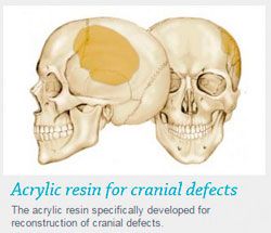 Acrylic resin for cranial defects